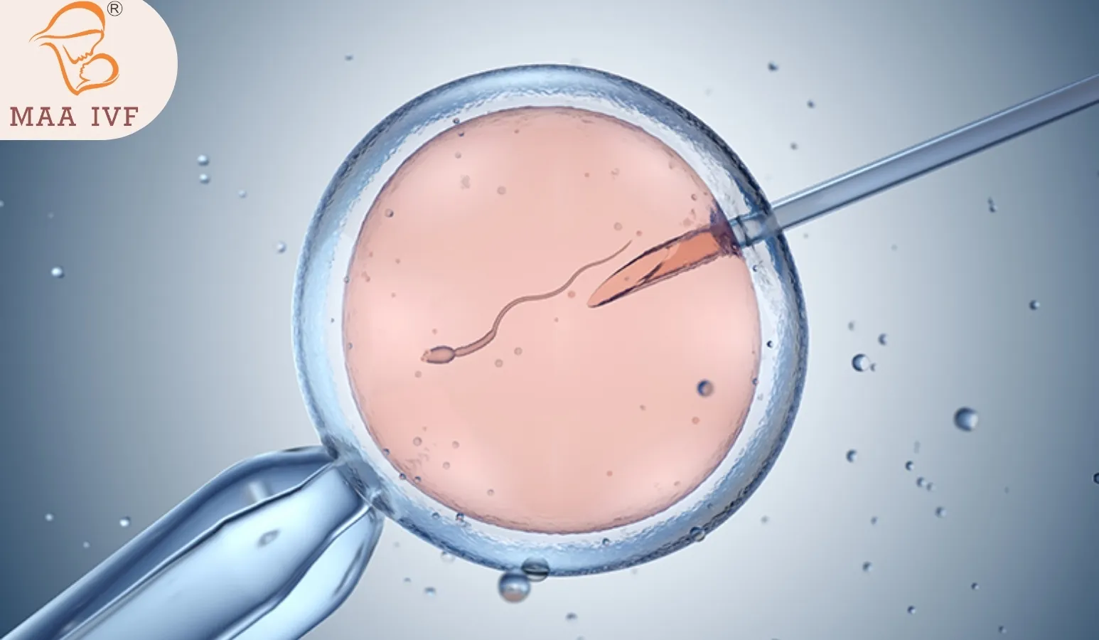 ICSI (INTRACYTOPLASMIC SPERM INJECTION) image 1