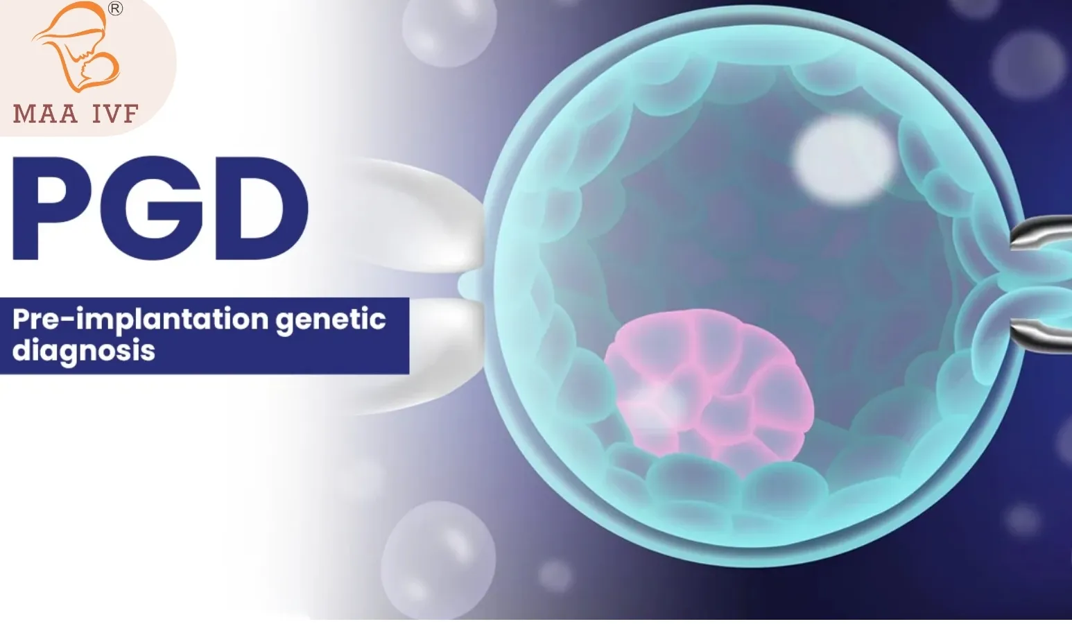 PGD – (PRE IMPLANTATION GENETIC DIAGNOSIS) image 1