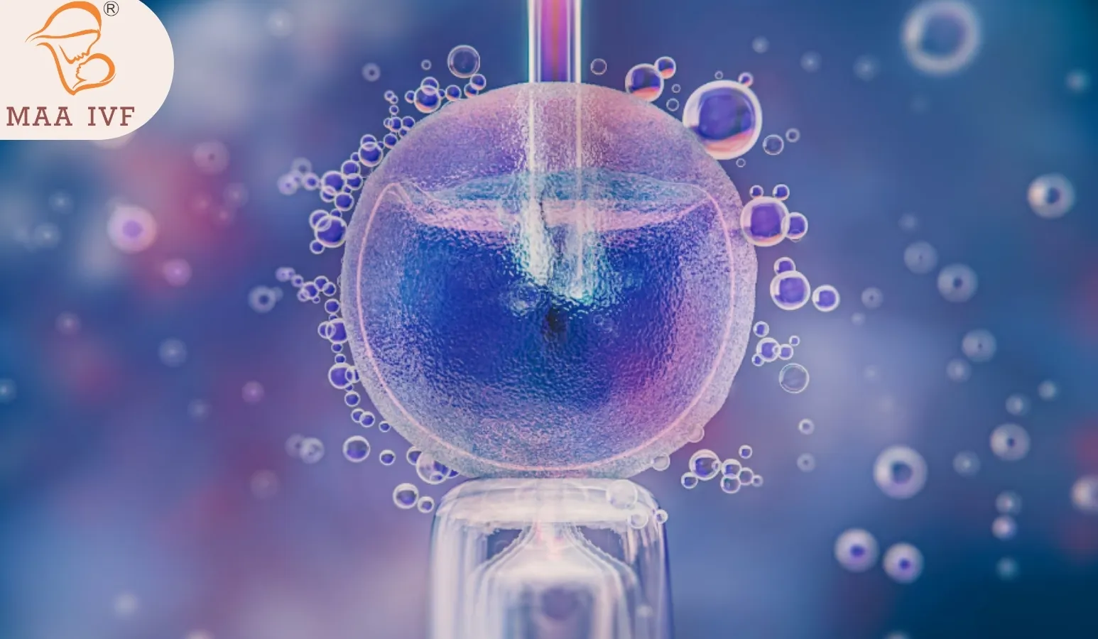 BLASTOCYST TRANSFER image 1