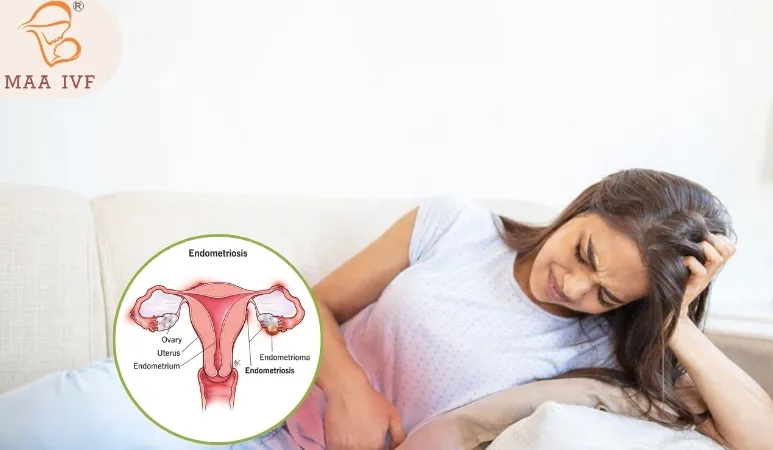 ENDOMETRIOSIS TREATMENT  image 1