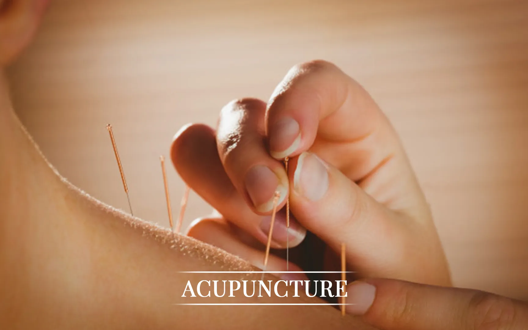 Ayurvedic Acupuncture Treatment image 1
