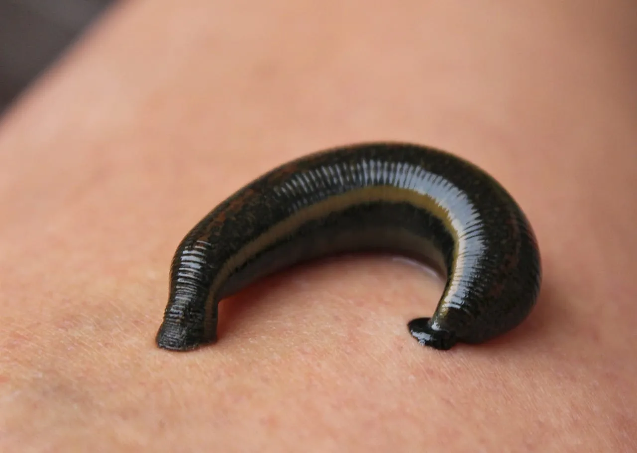 Leech Therapy Ayurveda image 1