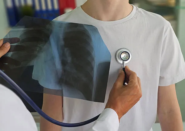 Lung Function Assessment & Monitoring image 1