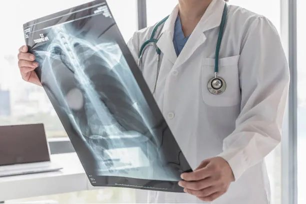 Bronchitis (Acute & Chronic) Treatment image 1
