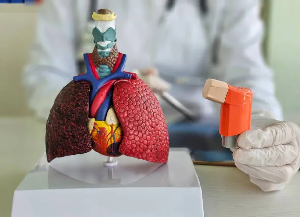 Asthma Diagnosis & Management image 1