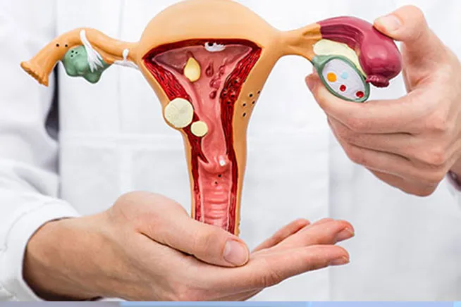 GYNEAC ONCOLOGY image 1