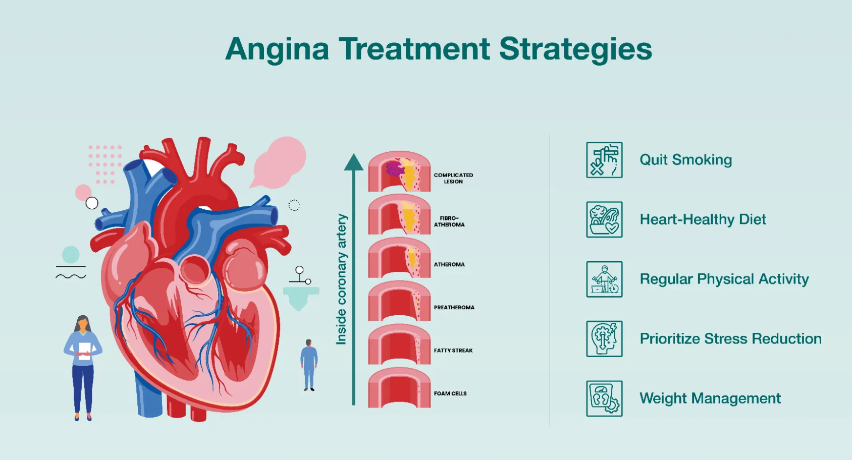 Angina Treatment image 1