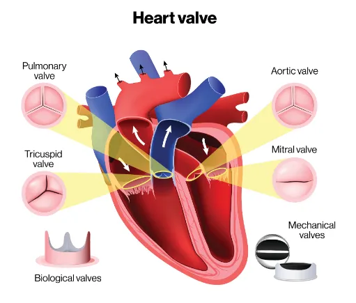 Valve Disease Treatment image 1