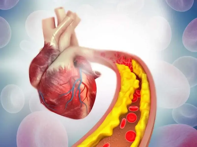 Cholesterol Management Treatment image 1