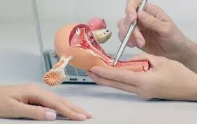 Gynecologic Laparoscopy image 1