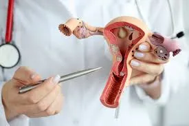 Endometriosis Surgery image 1