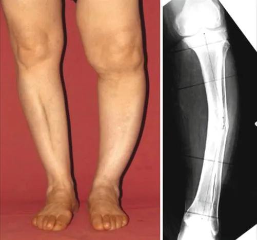 Deformity Correction image 1
