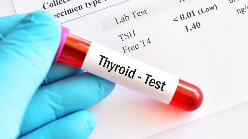 Thyroid Function Test (T3, T4, TSH) image 2