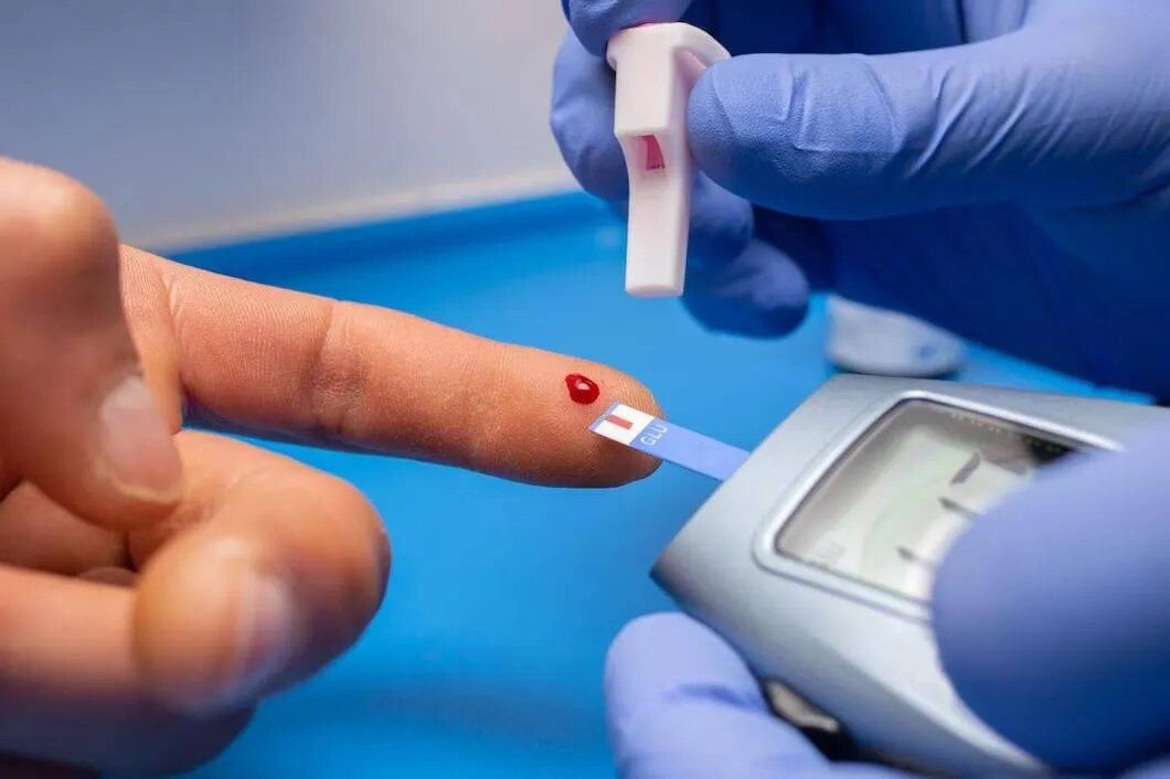 Blood Sugar Tests (Diabetes Testing) image 2