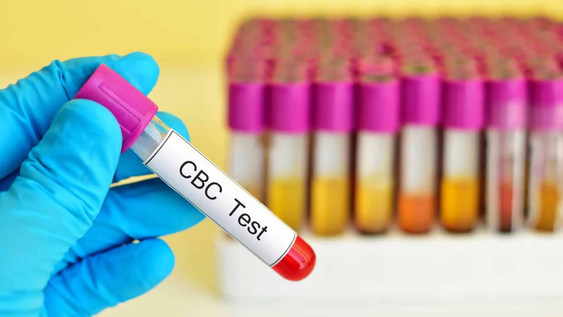 Complete Blood Count (CBC) image 1
