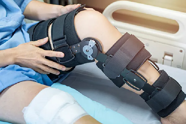Knee ligament injuries image 1
