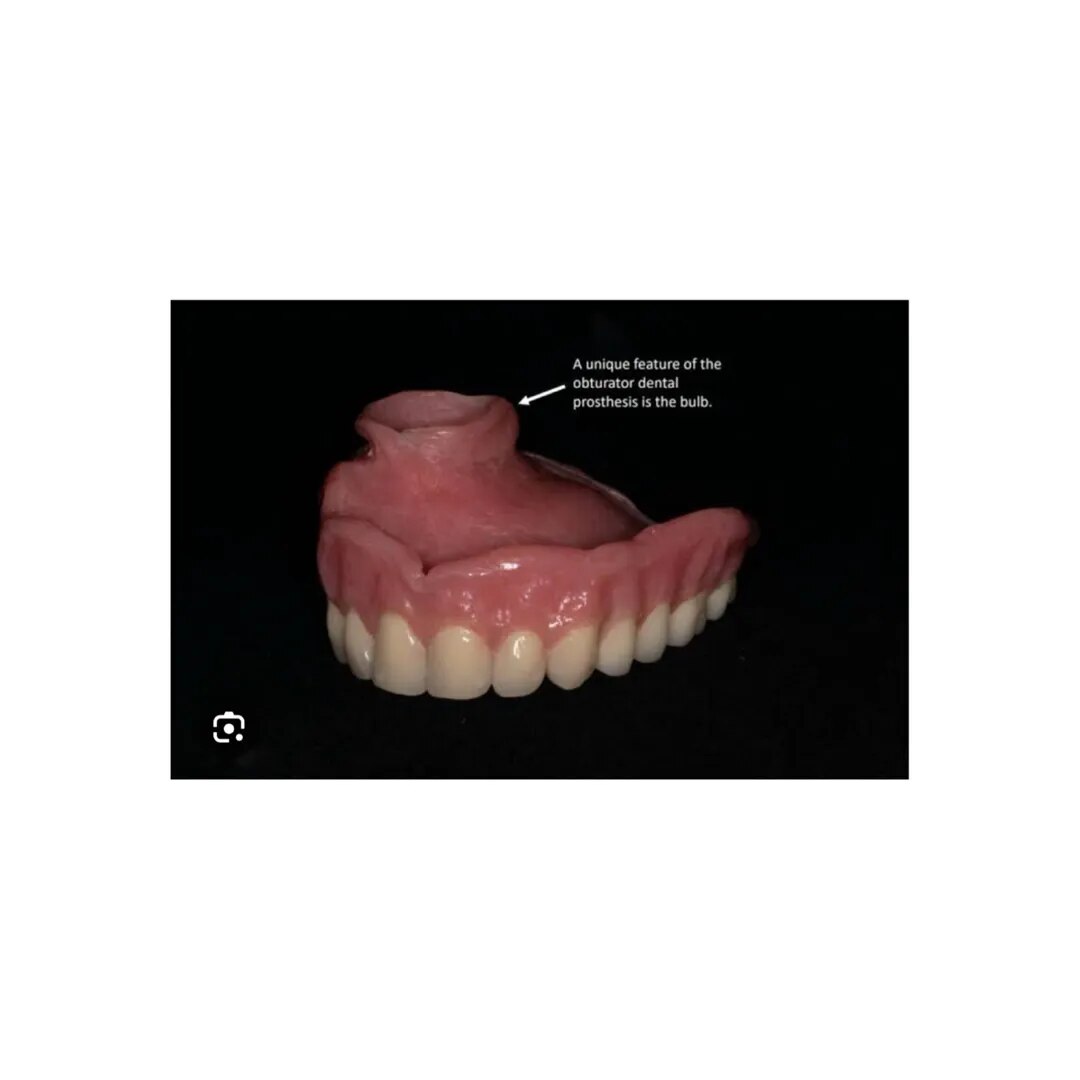 Palatal Obturator image 1