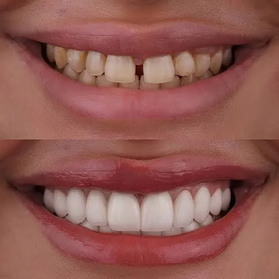 Cosmetic Dentistry image 1
