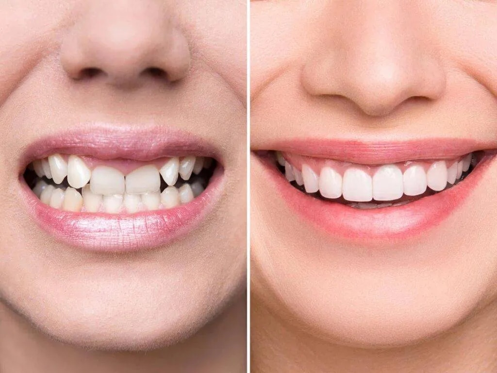Smile Designing image 1