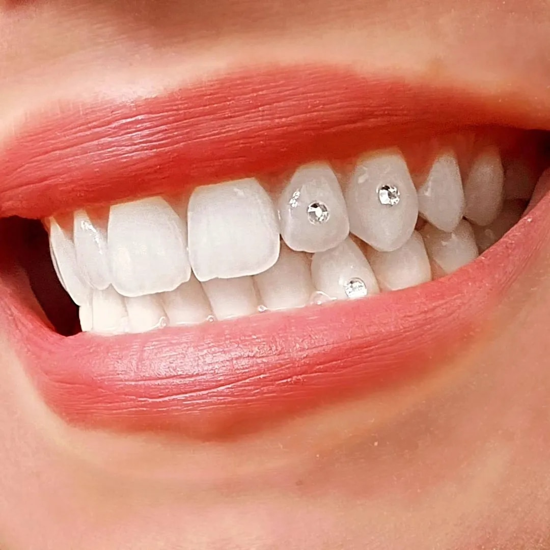 Tooth Jewellery image 1