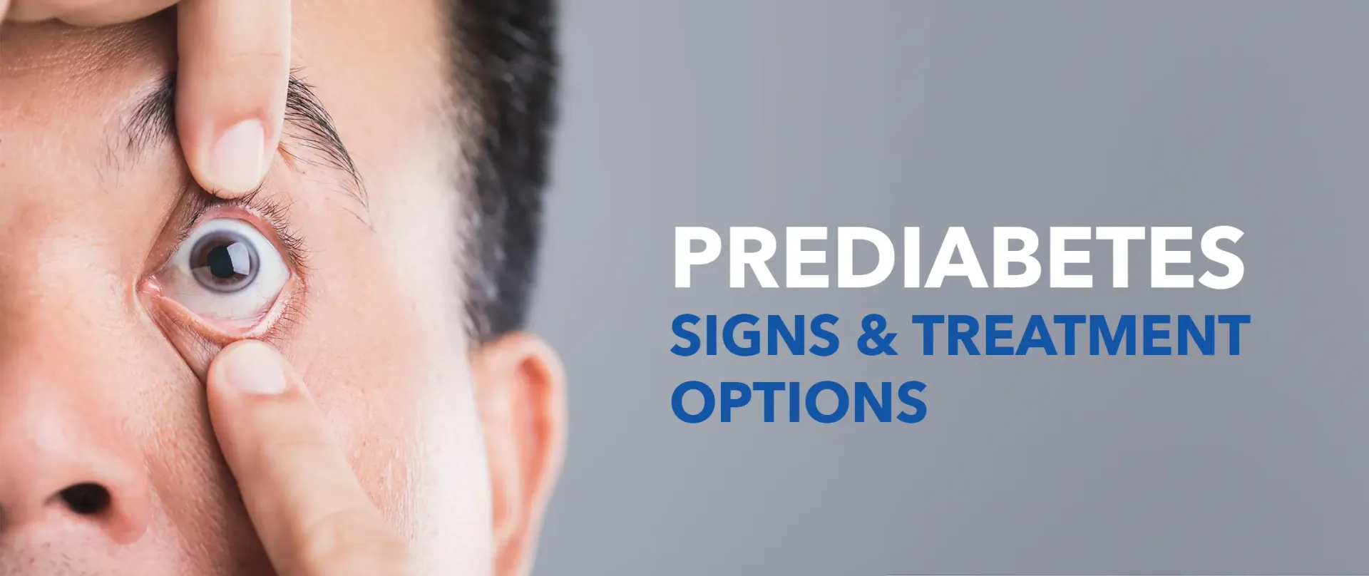Prediabetes Treatment image 1