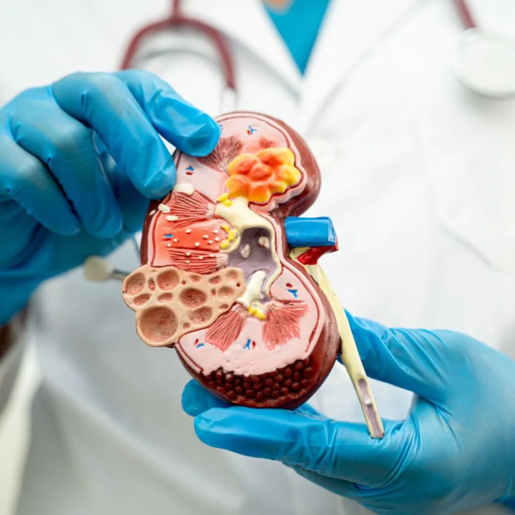 Diabetic Kidney Disease Treatment image 1