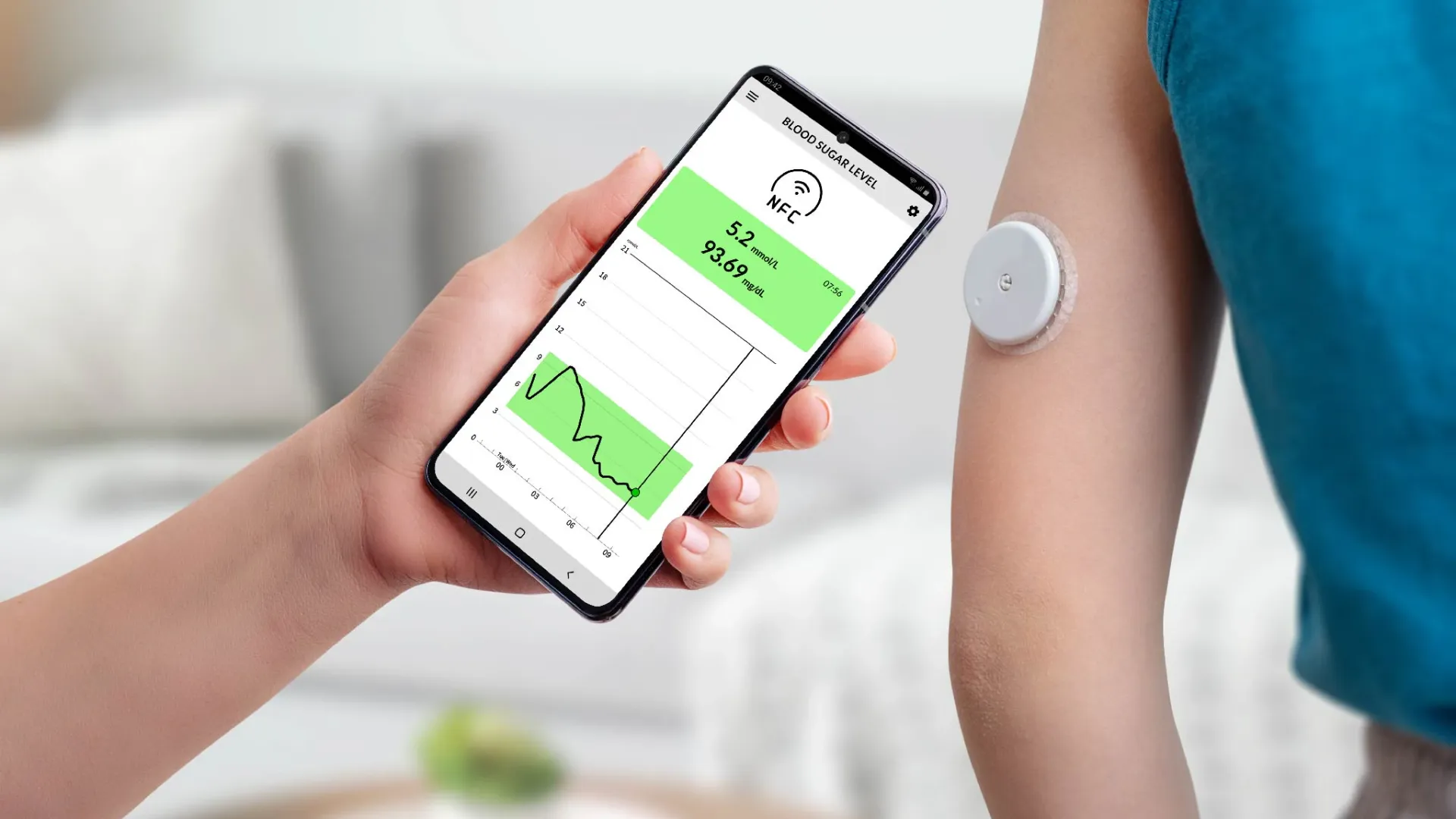 Continuous Glucose Monitoring (CGM) image 1