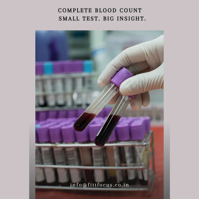 Complete Blood Count /CBC image 1