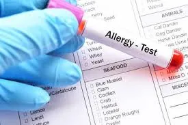 ALLERGY TESTING image 1