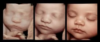 ULTRASOUND image 1