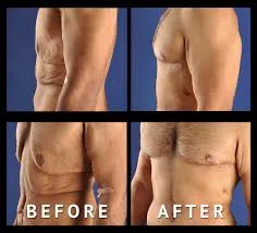 Weight Loss Surgery  image 1