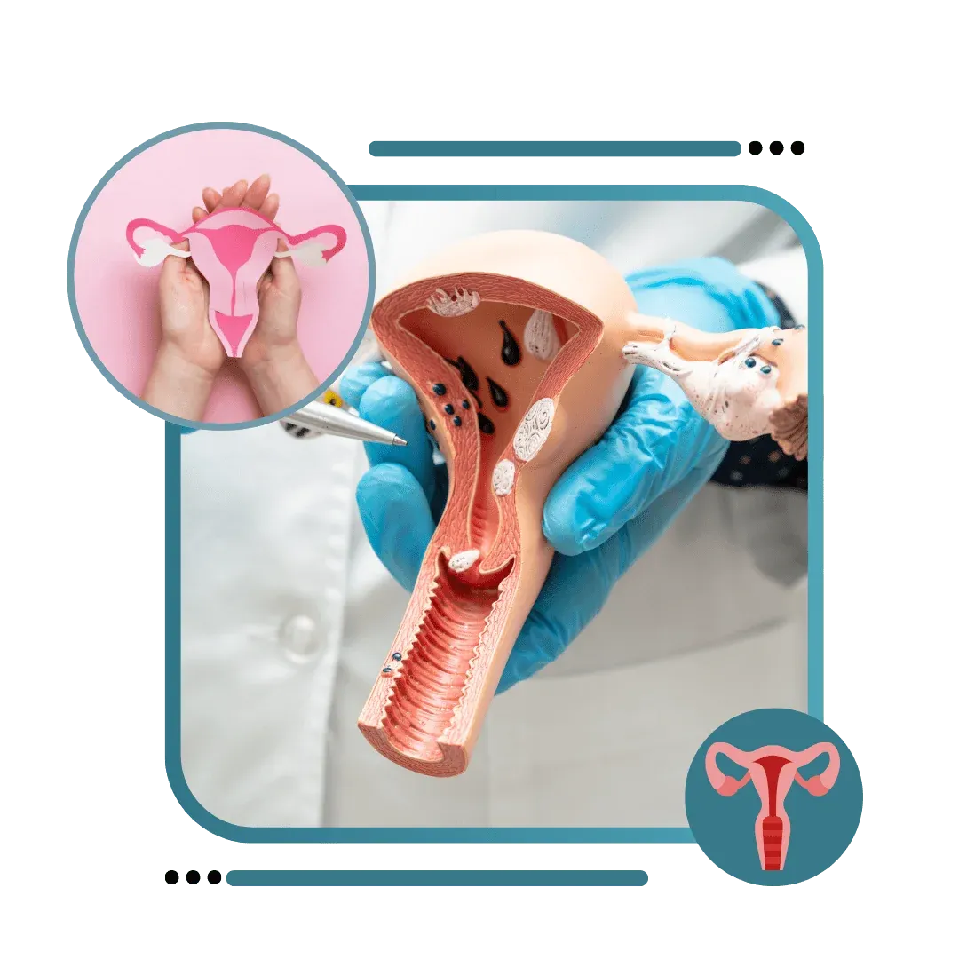 Female Genital Cosmetic Surgery image 1