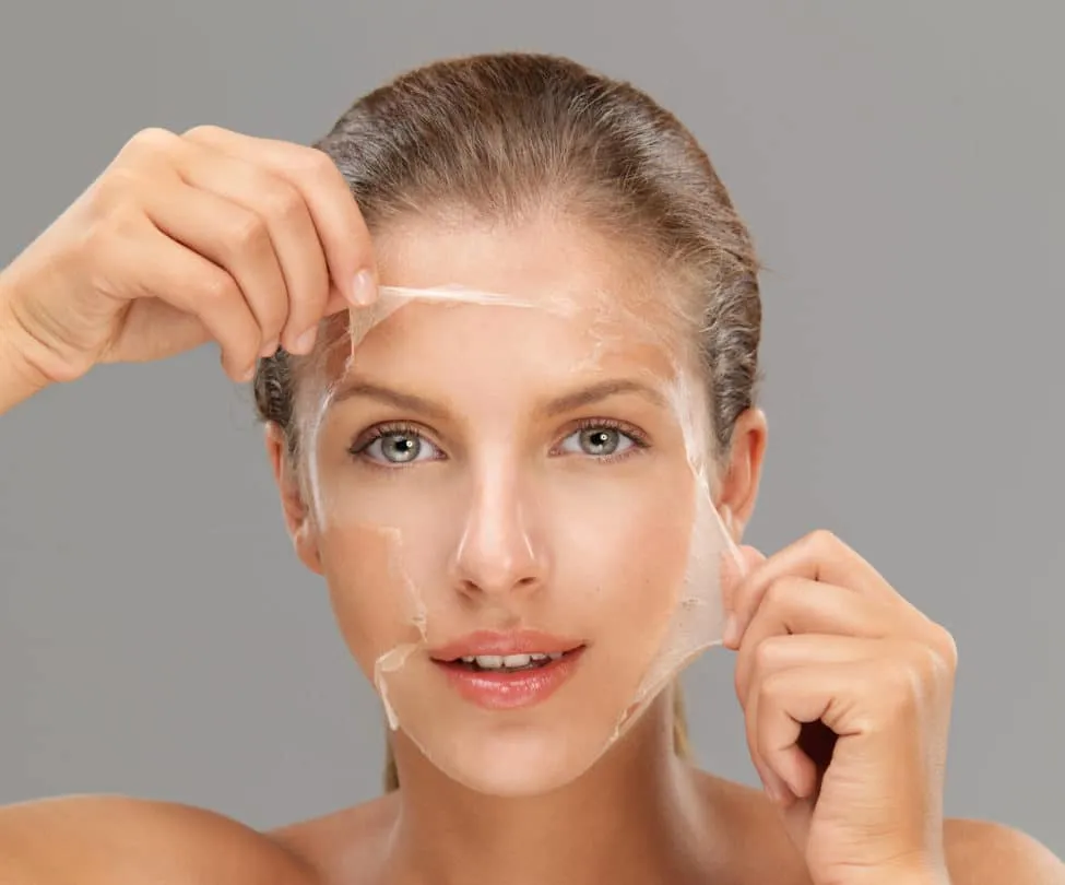 Chemical Peels image 1