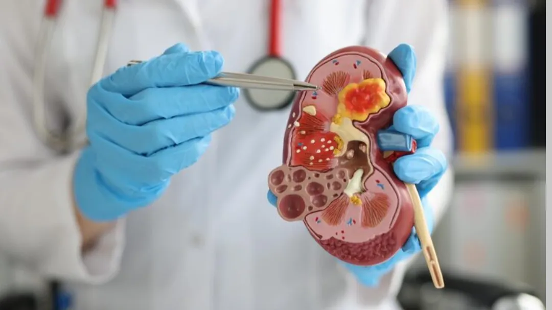 Urology Treatments image 1
