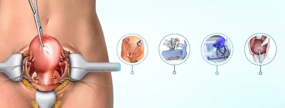 Uterus Removal Surgery  image 1
