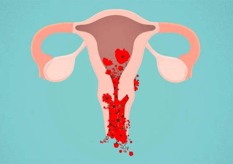 Menstrual Disorders Management image 1