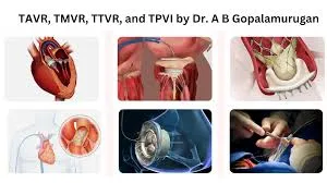 Structural Heart Procedures – TAVI, MitraClip & TriClip image 1