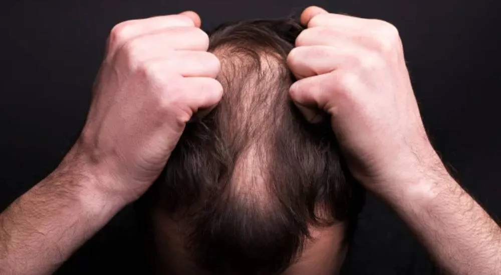 Hair Problem image 1