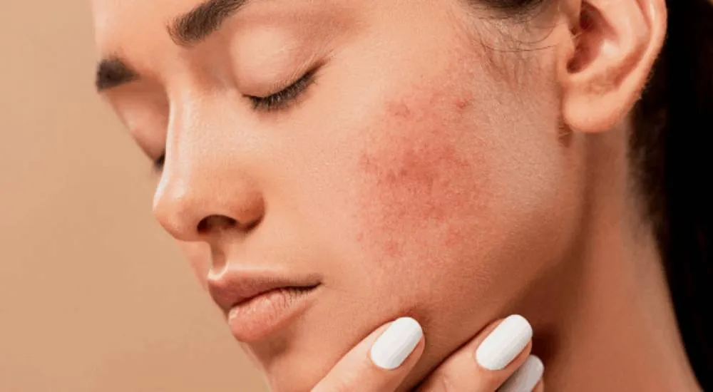 Skin Problems image 1