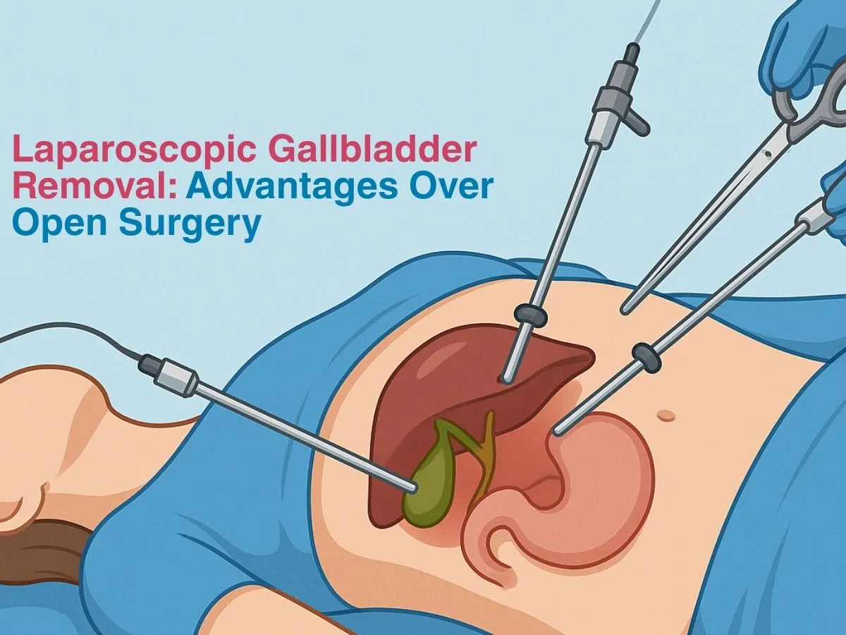 Laparoscopic Gallbladder Surgery image 1