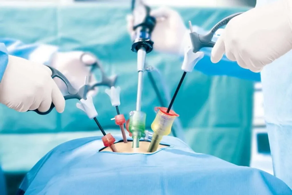 Keyhole Surgery  image 1