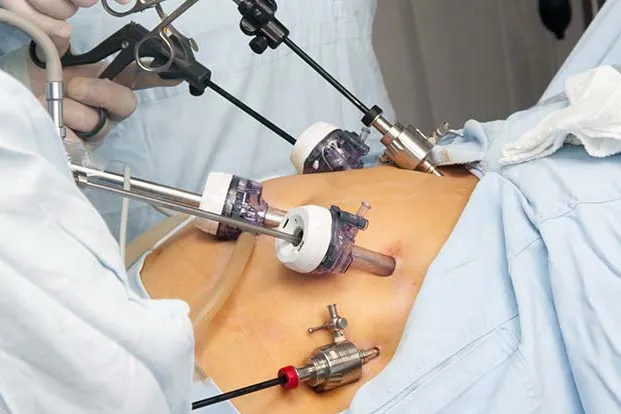 Minimally Invasive Surgery image 1