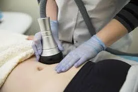 Laser Lipolysis image 1