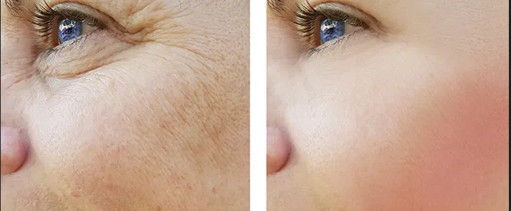  Skin Rejuvenation Treatment image 1
