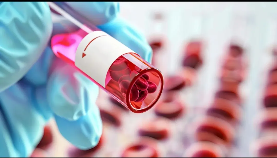 Hematology image 1