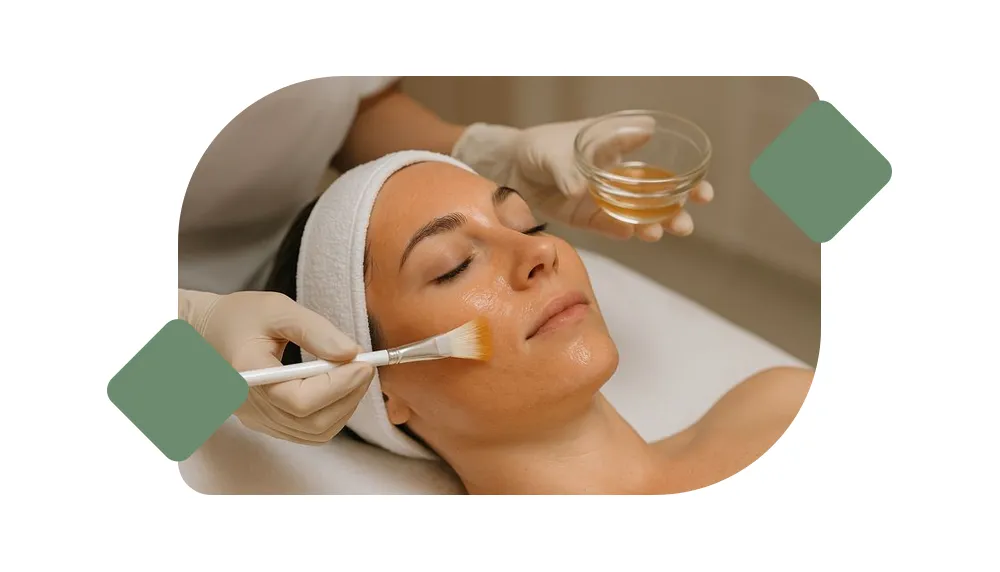 Chemical Peels image 1