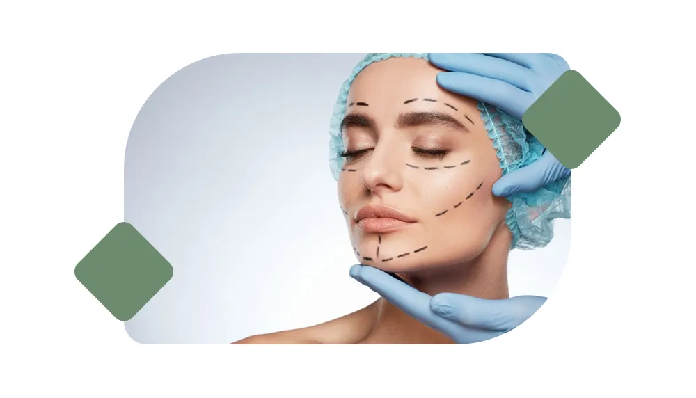 Face Lift image 1
