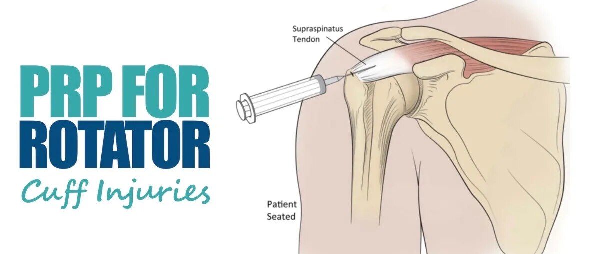 PRP Injection image 1