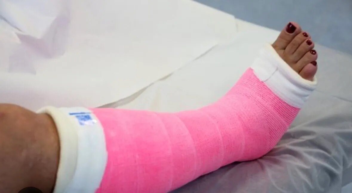 Plaster Cast image 1