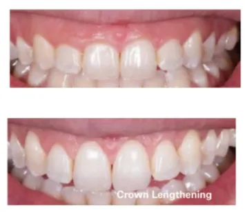 Periodontics image 1